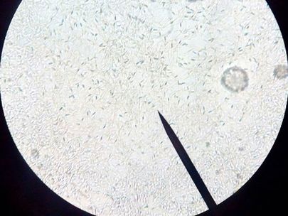 Clínica Veterinaria Finestrat bacterias